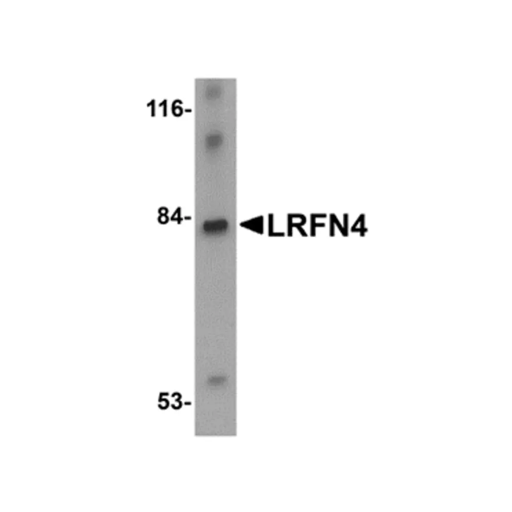 ProSci 5077 LRFN4 Antibody, ProSci, 0.1 mg/Unit Primary Image