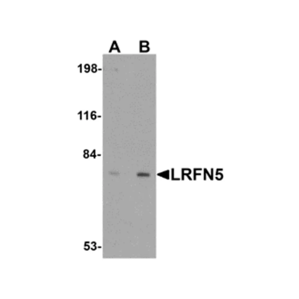 ProSci 5079_S LRFN5 Antibody, ProSci, 0.02 mg/Unit Primary Image