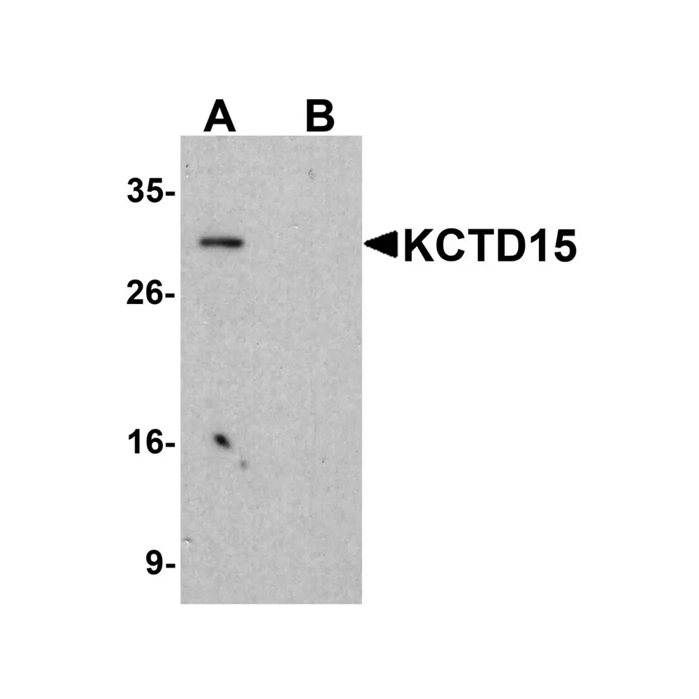 ProSci 5085 KCTD15 Antibody, ProSci, 0.1 mg/Unit Primary Image