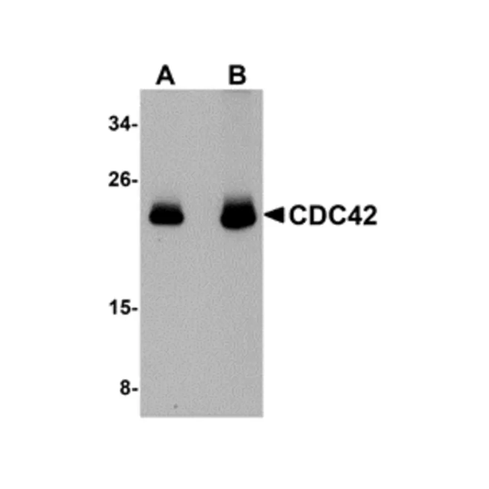 ProSci 5101_S CDC42 Antibody, ProSci, 0.02 mg/Unit Primary Image