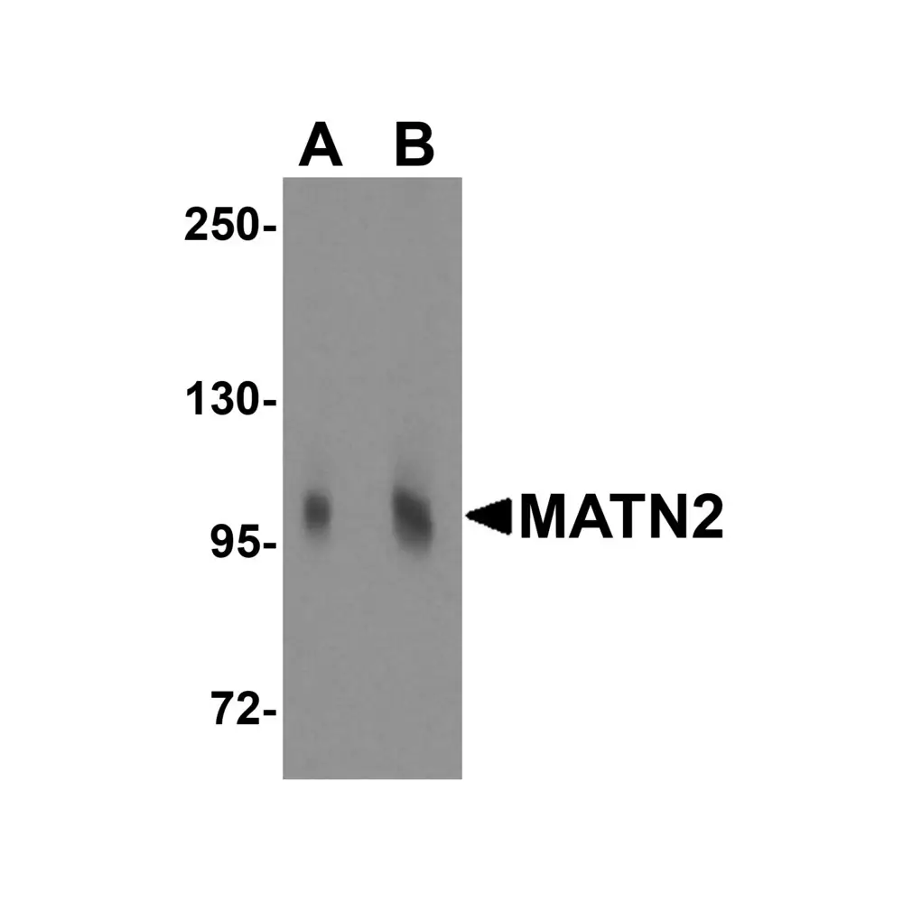 ProSci 5105_S MATN2 Antibody, ProSci, 0.02 mg/Unit Primary Image