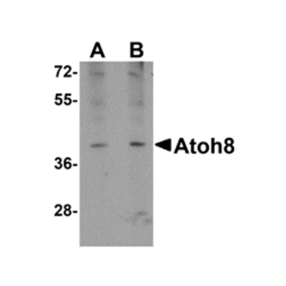 ProSci 5109_S ATOH8 Antibody, ProSci, 0.02 mg/Unit Primary Image