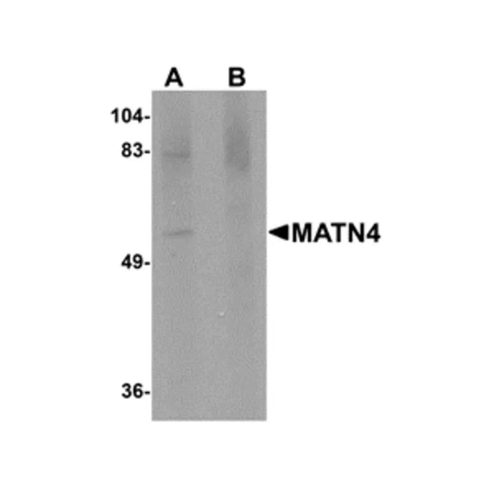ProSci 5115 MATN4 Antibody, ProSci, 0.1 mg/Unit Primary Image