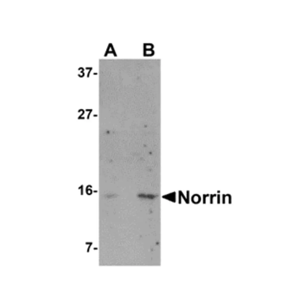 ProSci 5119 Norrin Antibody, ProSci, 0.1 mg/Unit Primary Image