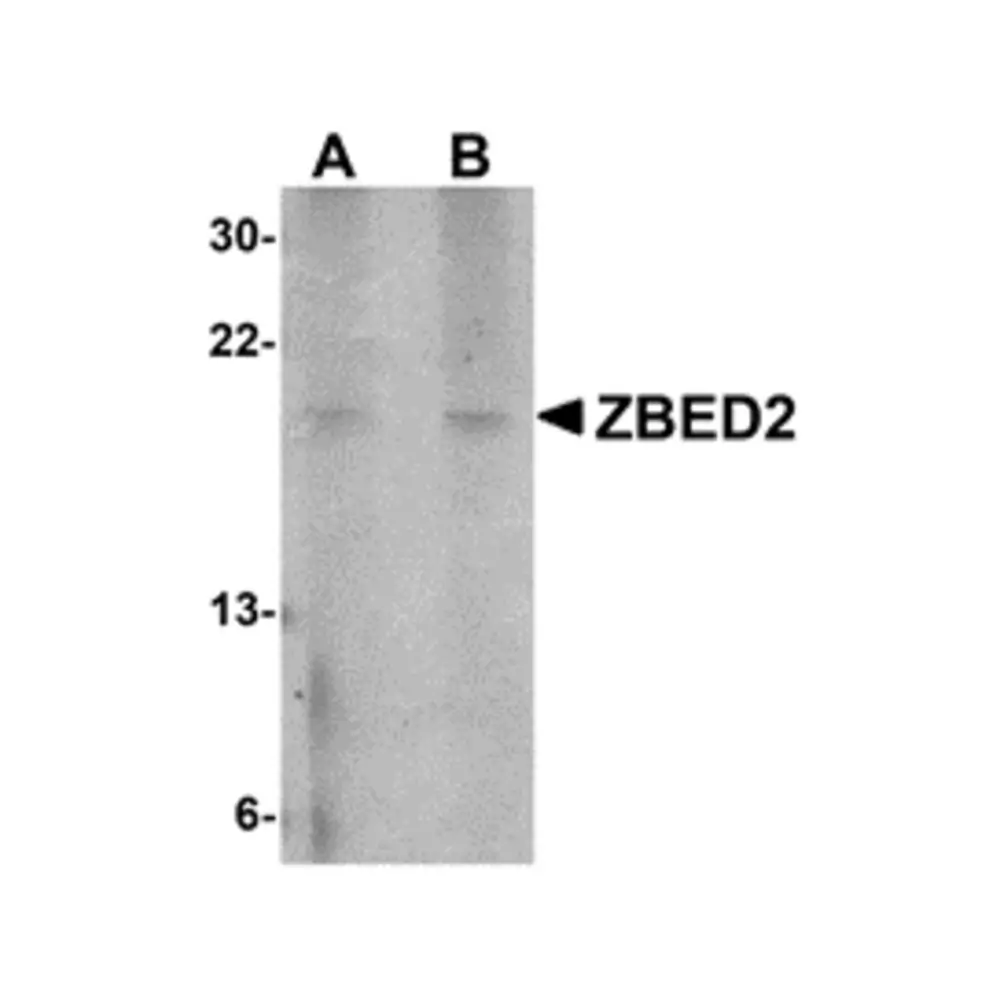 ProSci 5121_S ZBED2 Antibody, ProSci, 0.02 mg/Unit Primary Image