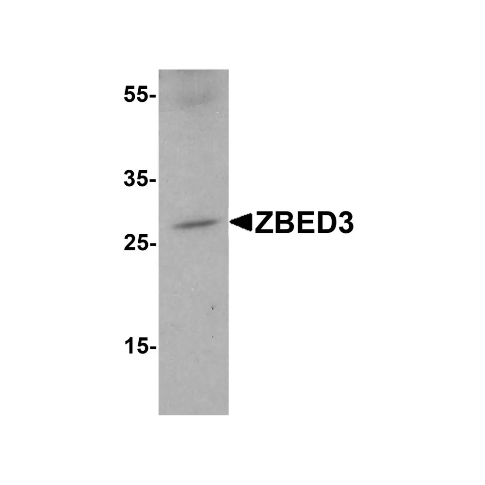 ProSci 5123 ZBED3 Antibody, ProSci, 0.1 mg/Unit Primary Image
