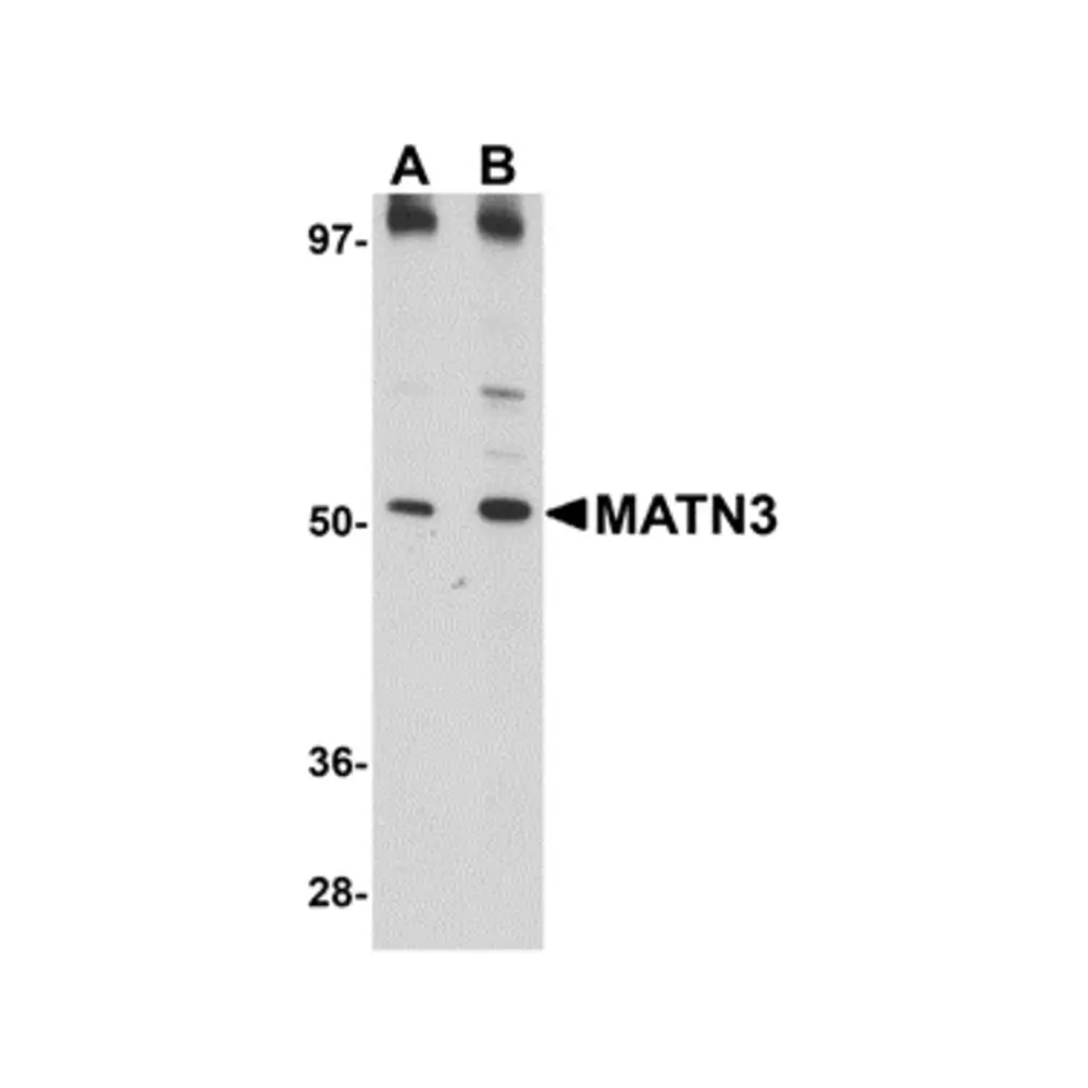 ProSci 5127 MATN3 Antibody, ProSci, 0.1 mg/Unit Primary Image