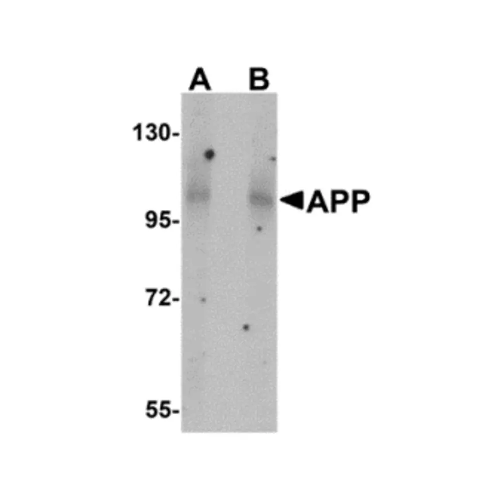 ProSci 5129 APP Antibody, ProSci, 0.1 mg/Unit Primary Image