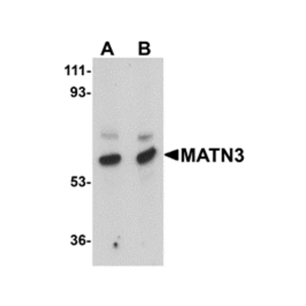 ProSci 5141 MATN3 Antibody, ProSci, 0.1 mg/Unit Primary Image