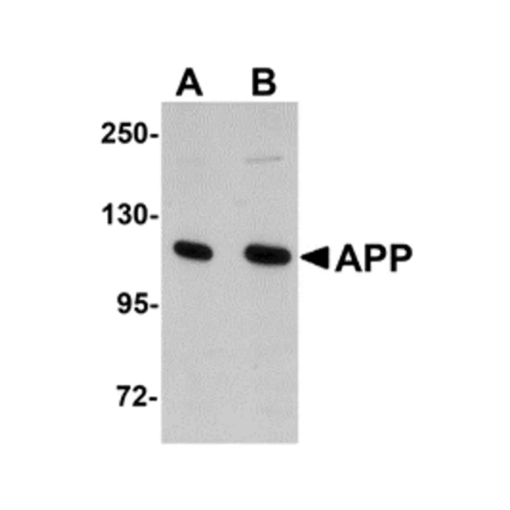 ProSci 5143_S APP Antibody, ProSci, 0.02 mg/Unit Primary Image