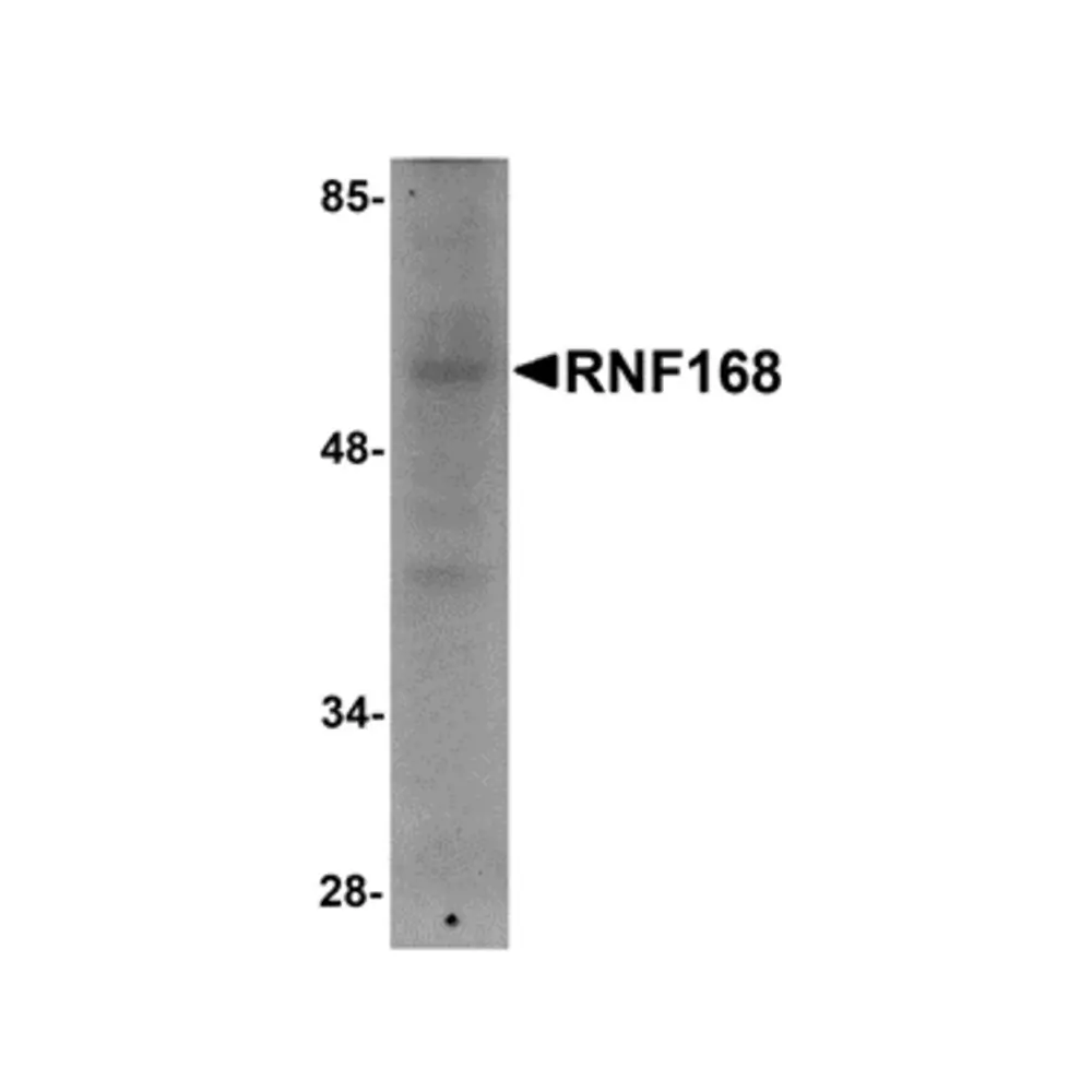 ProSci 5147_S RNF168 Antibody, ProSci, 0.02 mg/Unit Primary Image