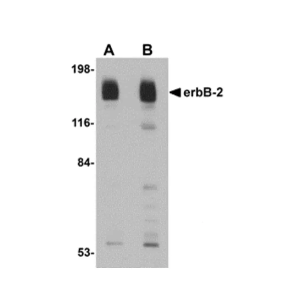ProSci 5153 erbB-2 Antibody, ProSci, 0.1 mg/Unit Primary Image
