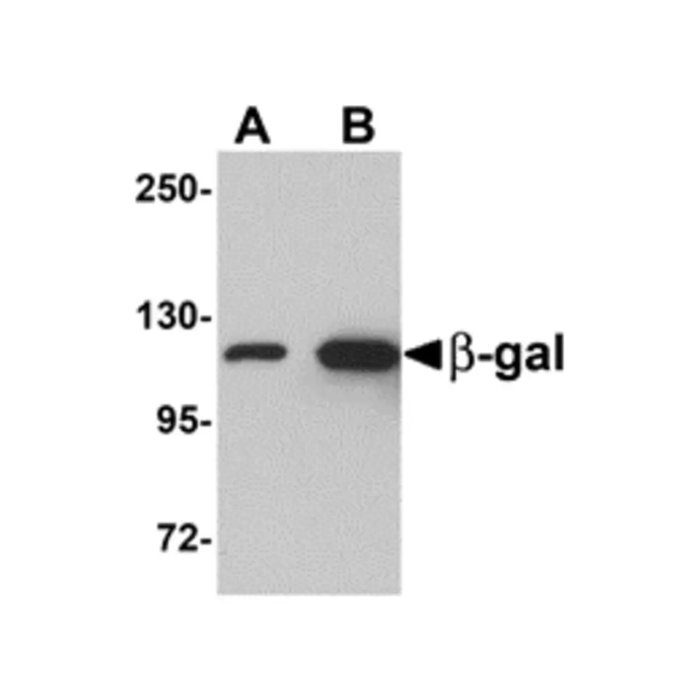 ProSci 5155 beta-Galactosidase Antibody, ProSci, 0.1 mg/Unit Primary Image