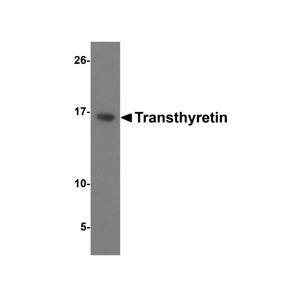 ProSci 5157 Transthyretin Antibody, ProSci, 0.1 mg/Unit Primary Image
