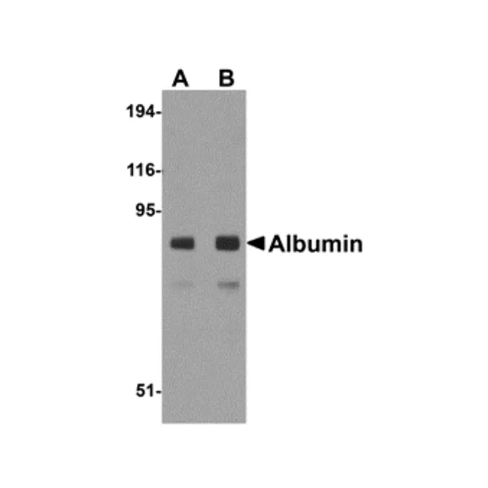 ProSci 5159_S Albumin Antibody, ProSci, 0.02 mg/Unit Primary Image