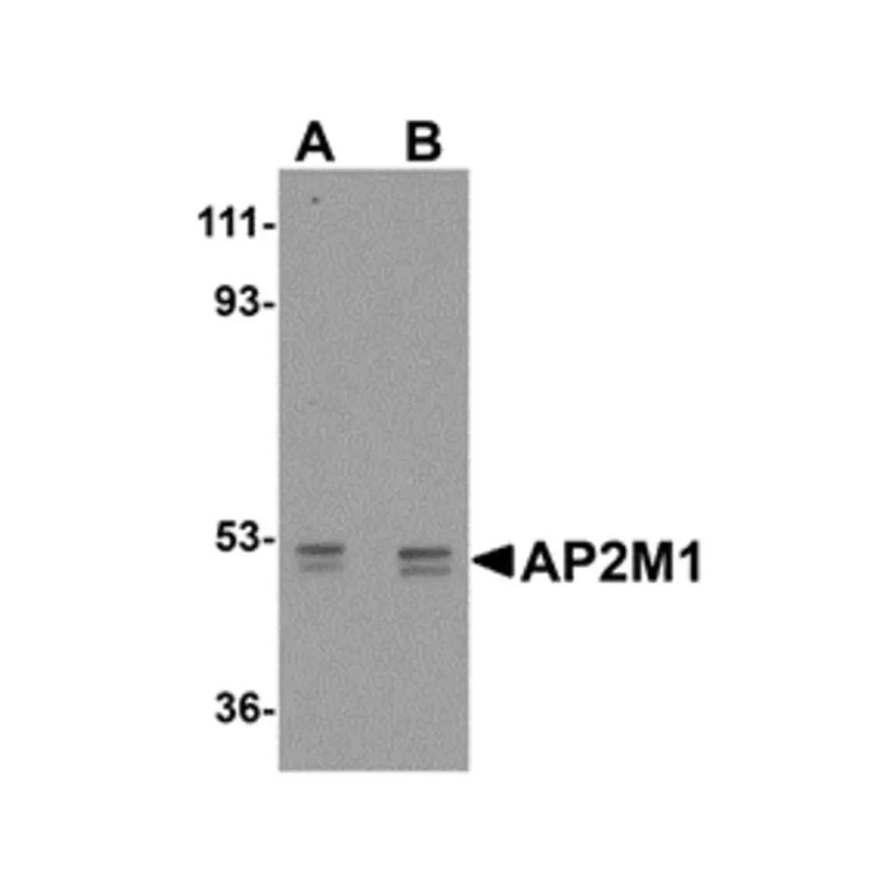 ProSci 5161_S AP2M1 Antibody, ProSci, 0.02 mg/Unit Primary Image
