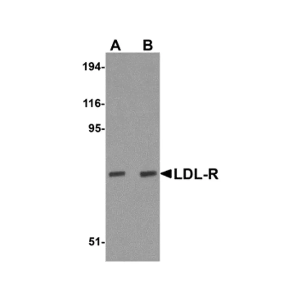 ProSci 5163_S LDL-R Antibody, ProSci, 0.02 mg/Unit Primary Image