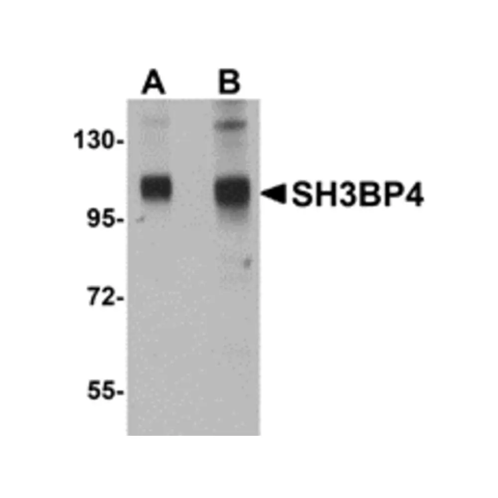 ProSci 5167 SH3BP4 Antibody, ProSci, 0.1 mg/Unit Primary Image