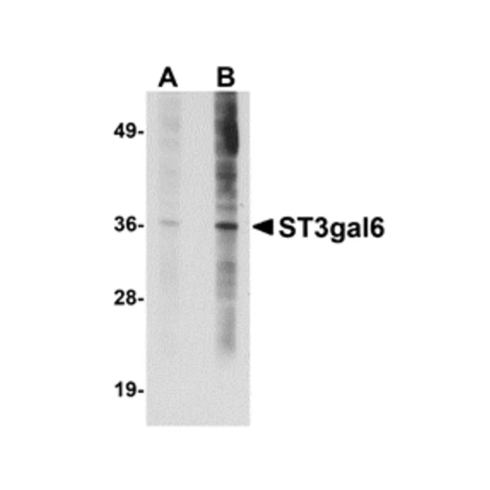 ProSci 5169 ST3gal6 Antibody, ProSci, 0.1 mg/Unit Primary Image