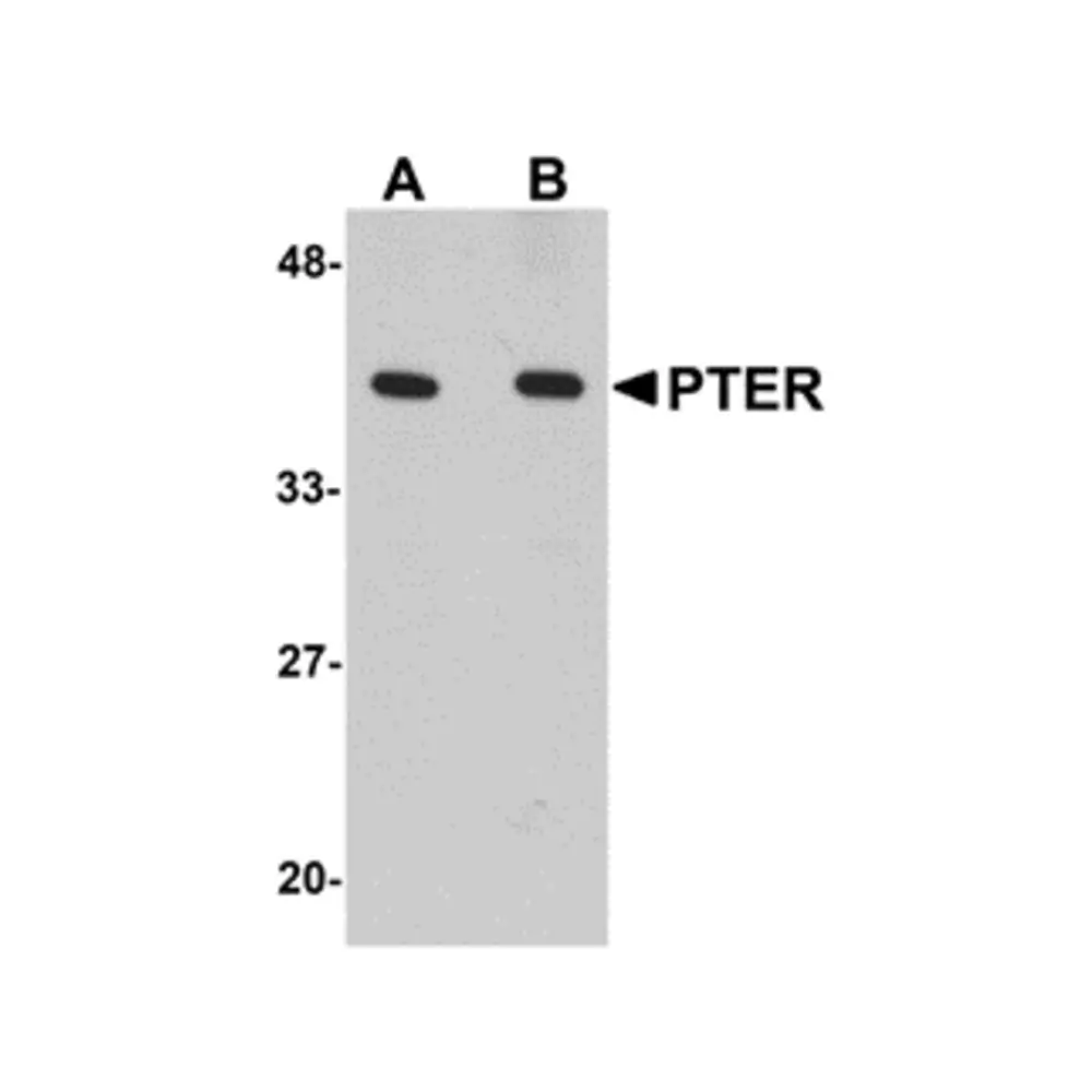 ProSci 5173 PTER Antibody, ProSci, 0.1 mg/Unit Primary Image