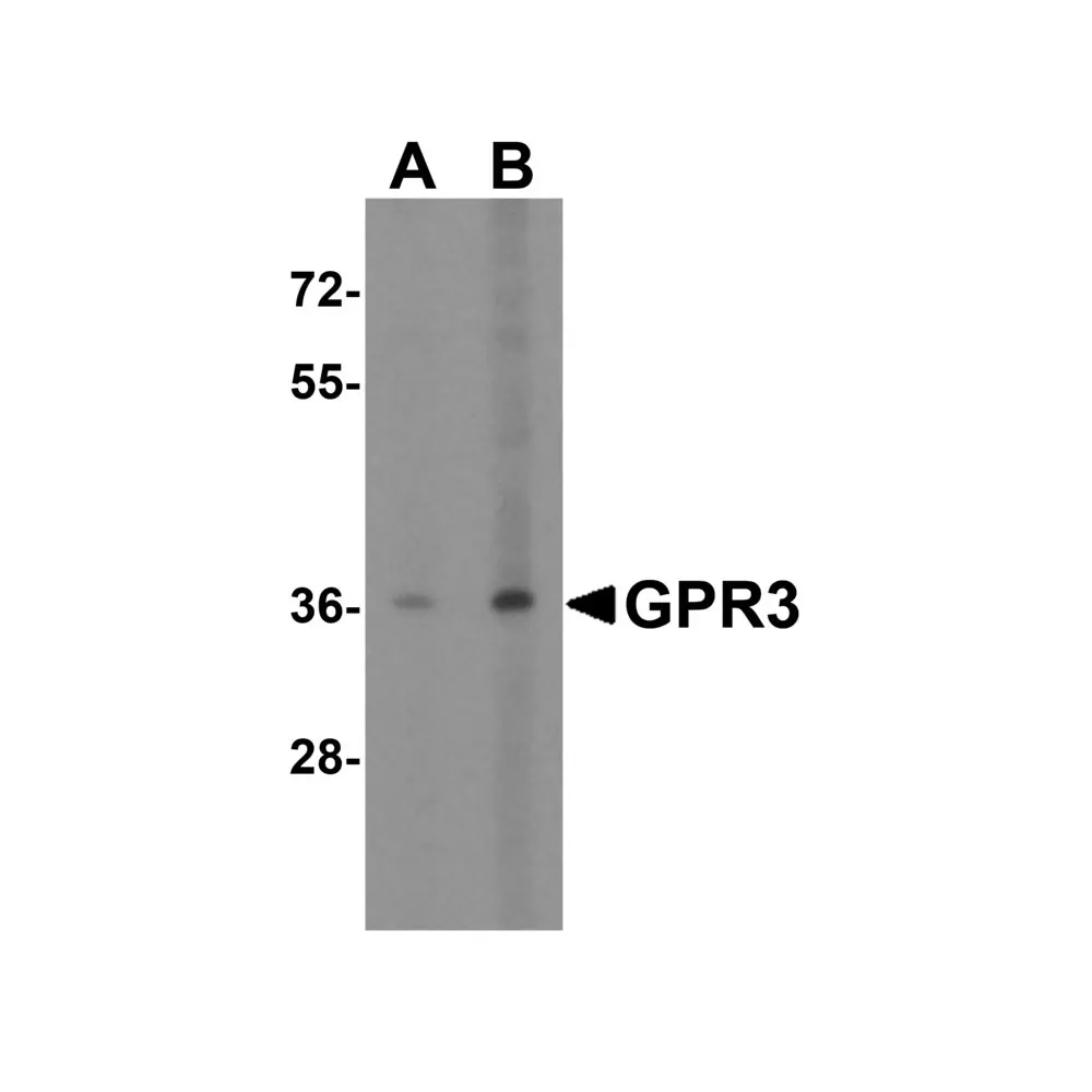 ProSci 5175 GPR3 Antibody, ProSci, 0.1 mg/Unit Primary Image