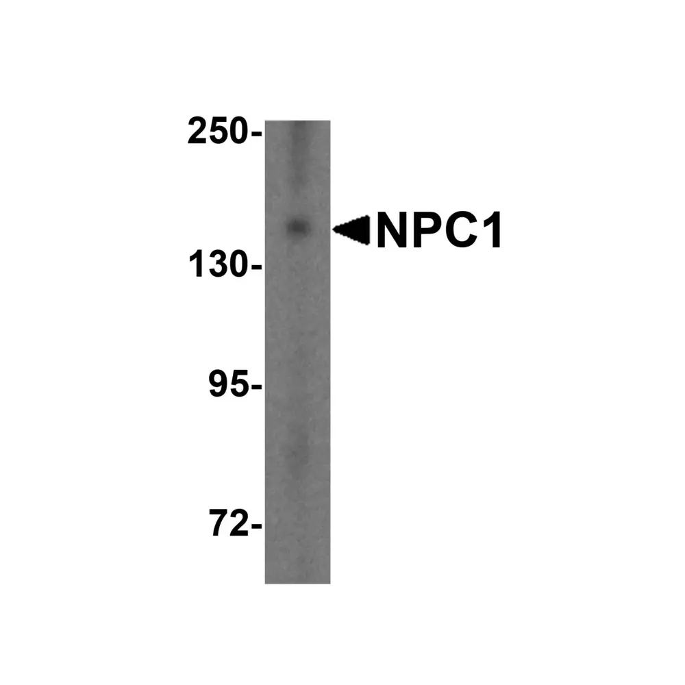 ProSci 5185 NPC1 Antibody, ProSci, 0.1 mg/Unit Primary Image