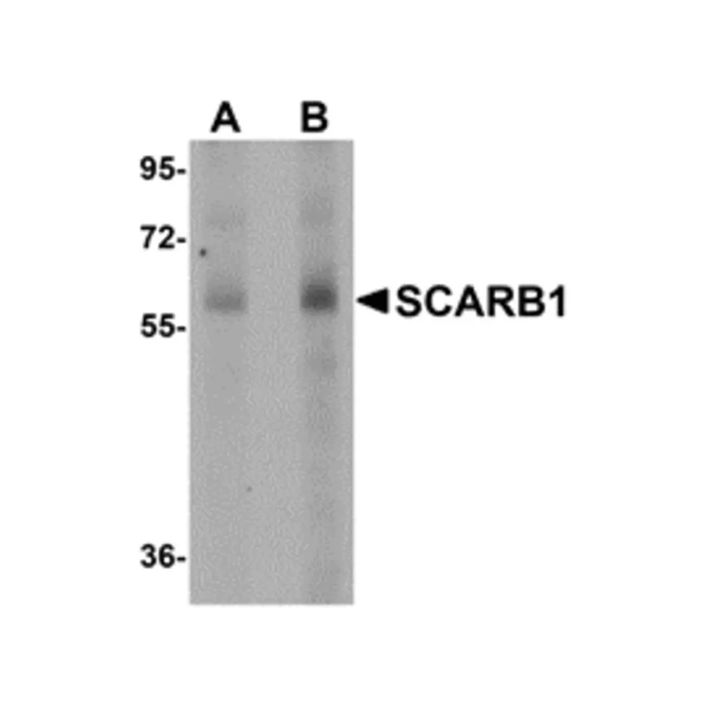 ProSci 5193 SCARB1 Antibody, ProSci, 0.1 mg/Unit Primary Image
