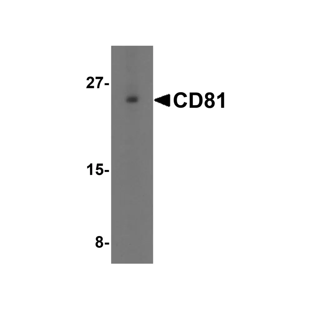 ProSci 5195 CD81 Antibody, ProSci, 0.1 mg/Unit Primary Image