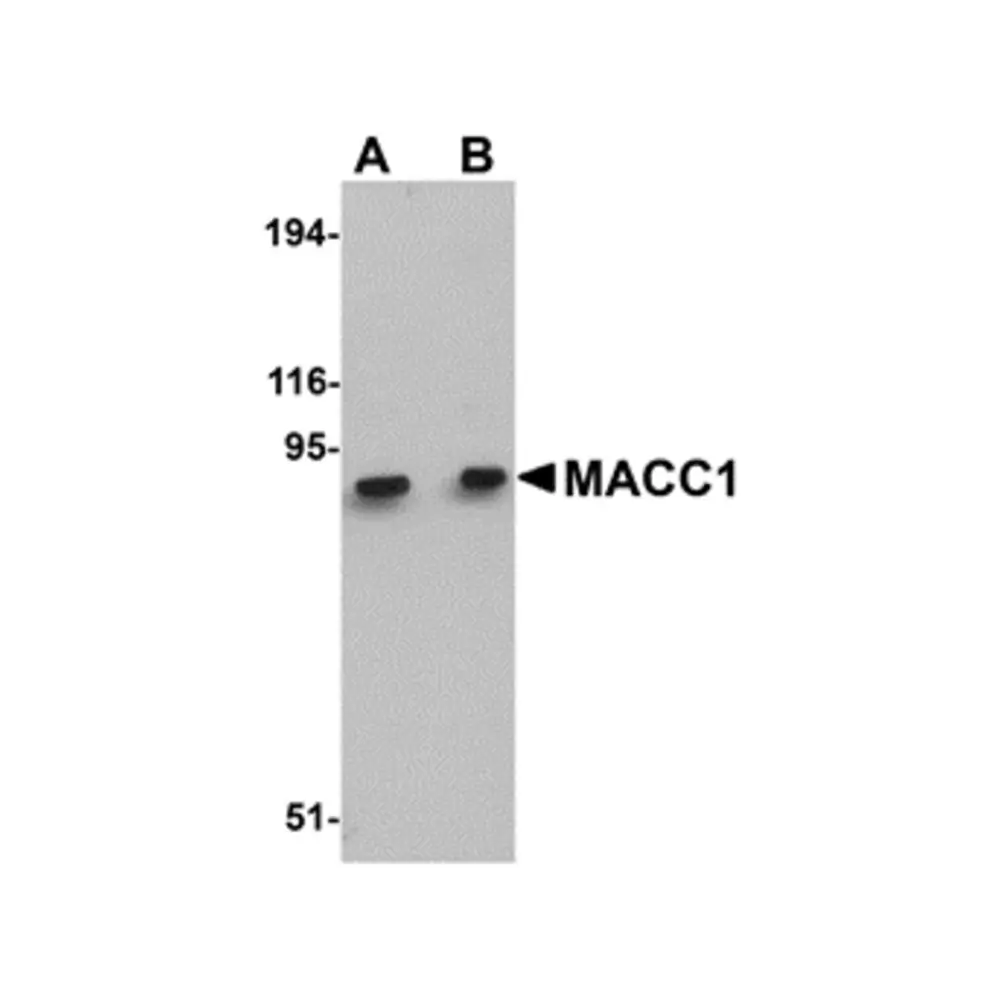ProSci 5197 MACC1 Antibody, ProSci, 0.1 mg/Unit Primary Image