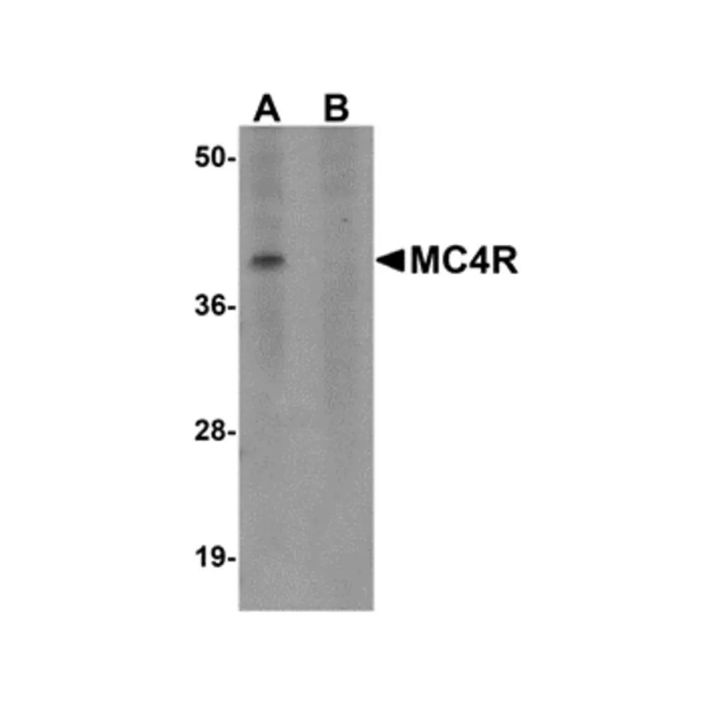 ProSci 5199_S MC4R Antibody, ProSci, 0.02 mg/Unit Primary Image