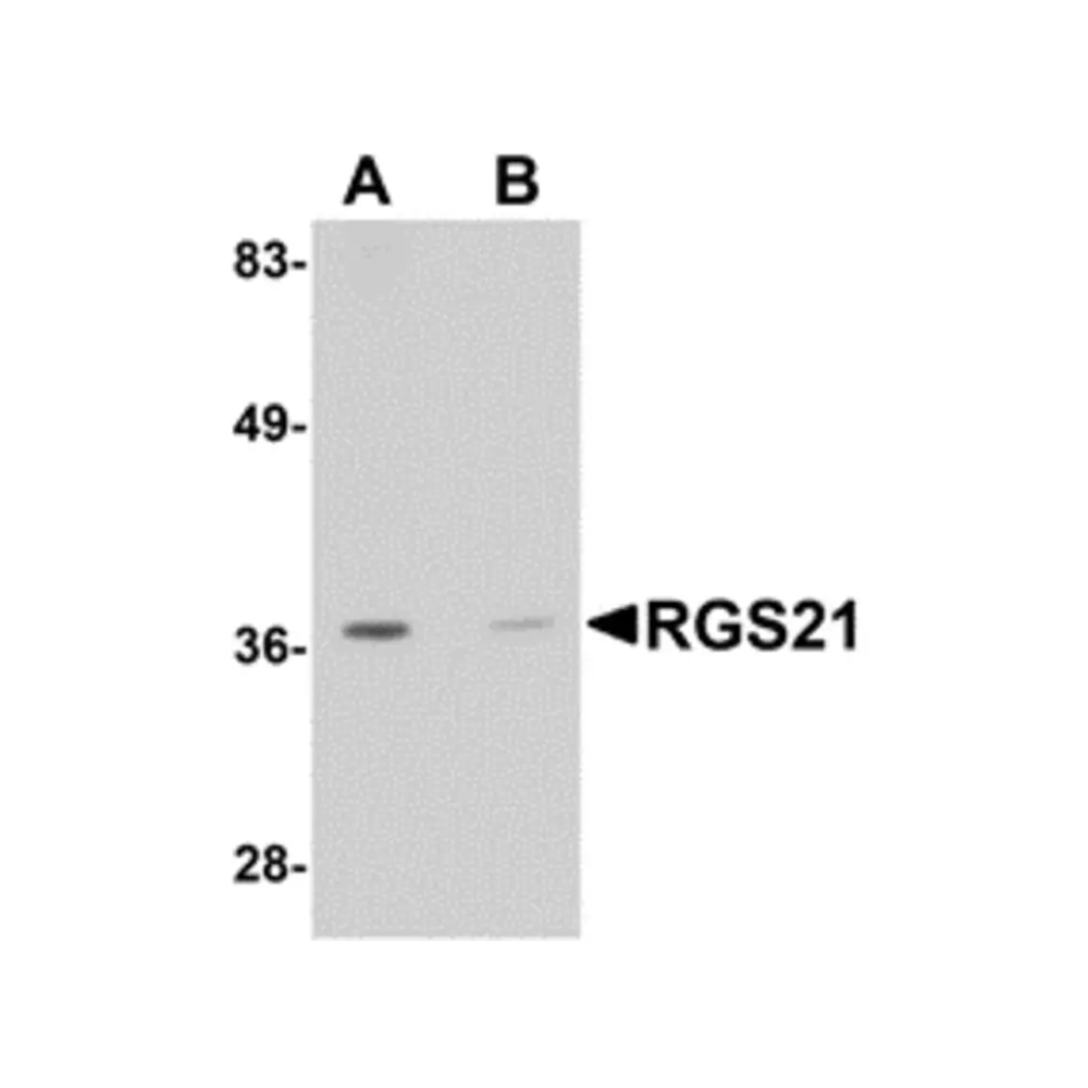 ProSci 5209_S RGS21 Antibody, ProSci, 0.02 mg/Unit Primary Image