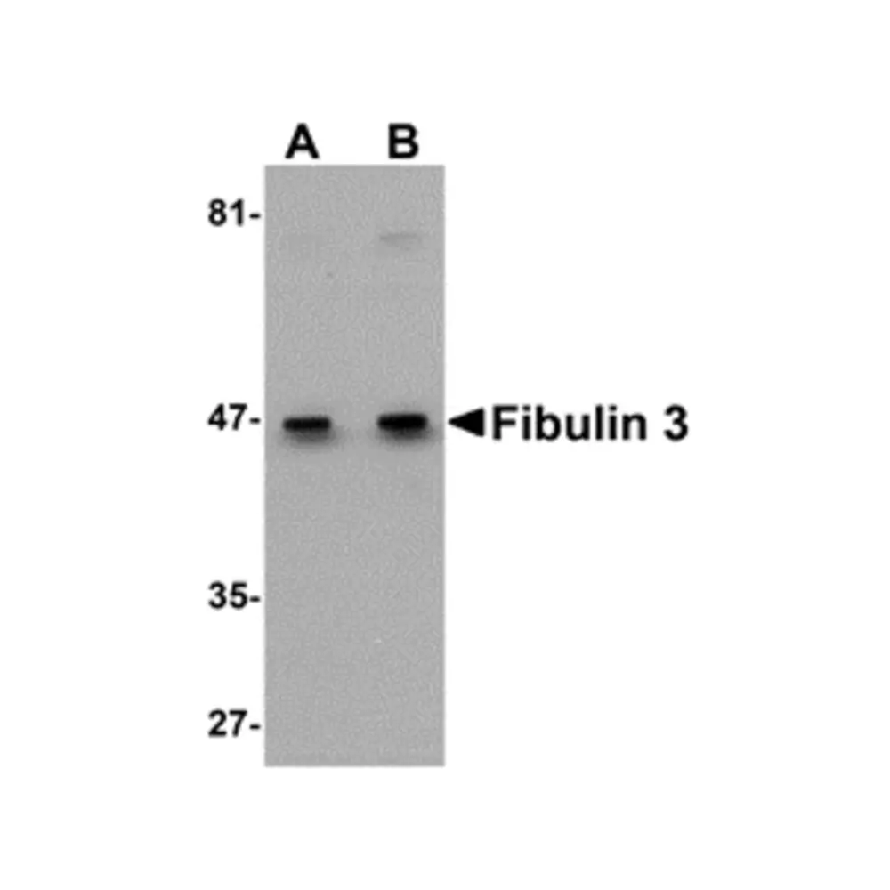 ProSci 5213_S Fibulin 3 Antibody, ProSci, 0.02 mg/Unit Primary Image