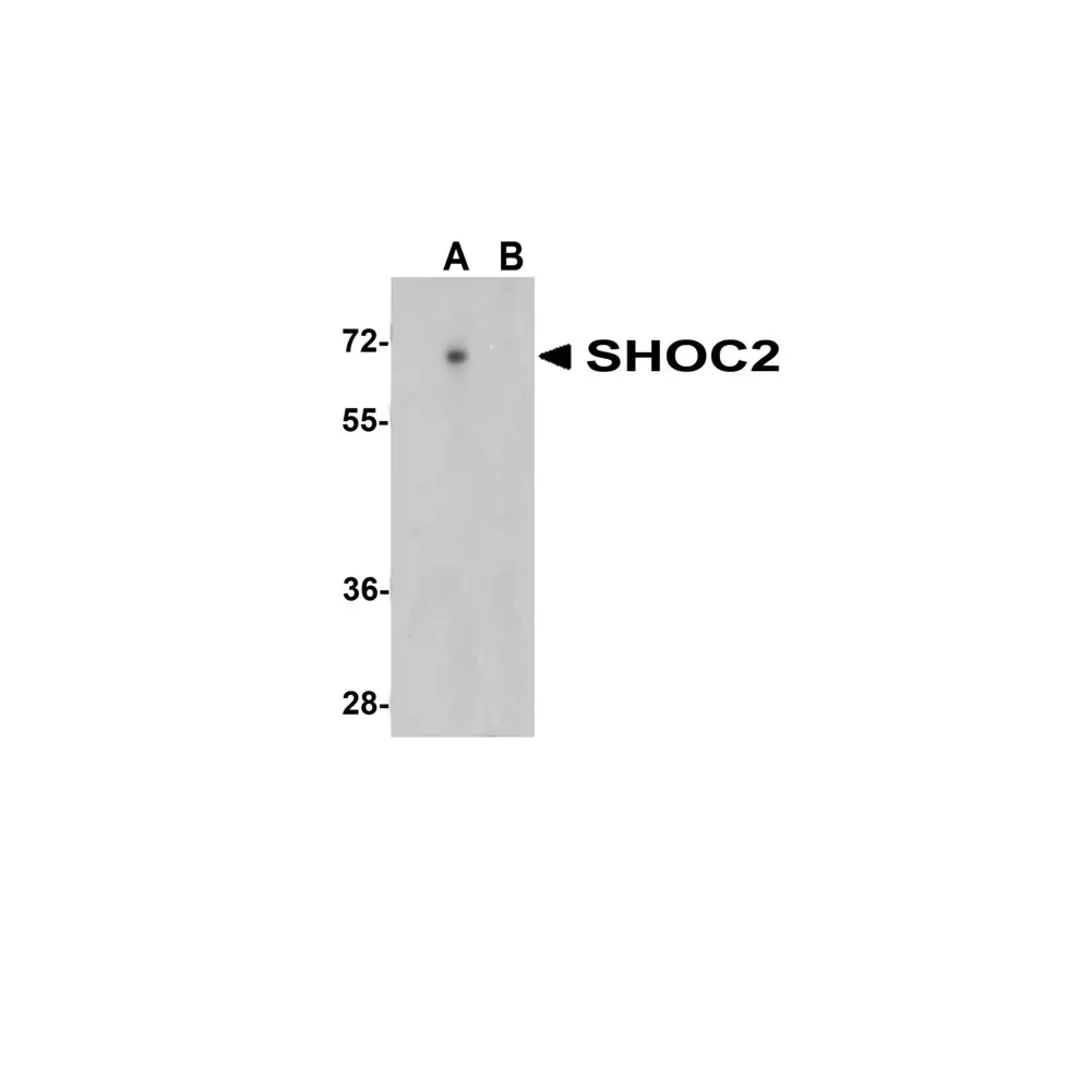 ProSci 5215_S SHOC2 Antibody, ProSci, 0.02 mg/Unit Primary Image