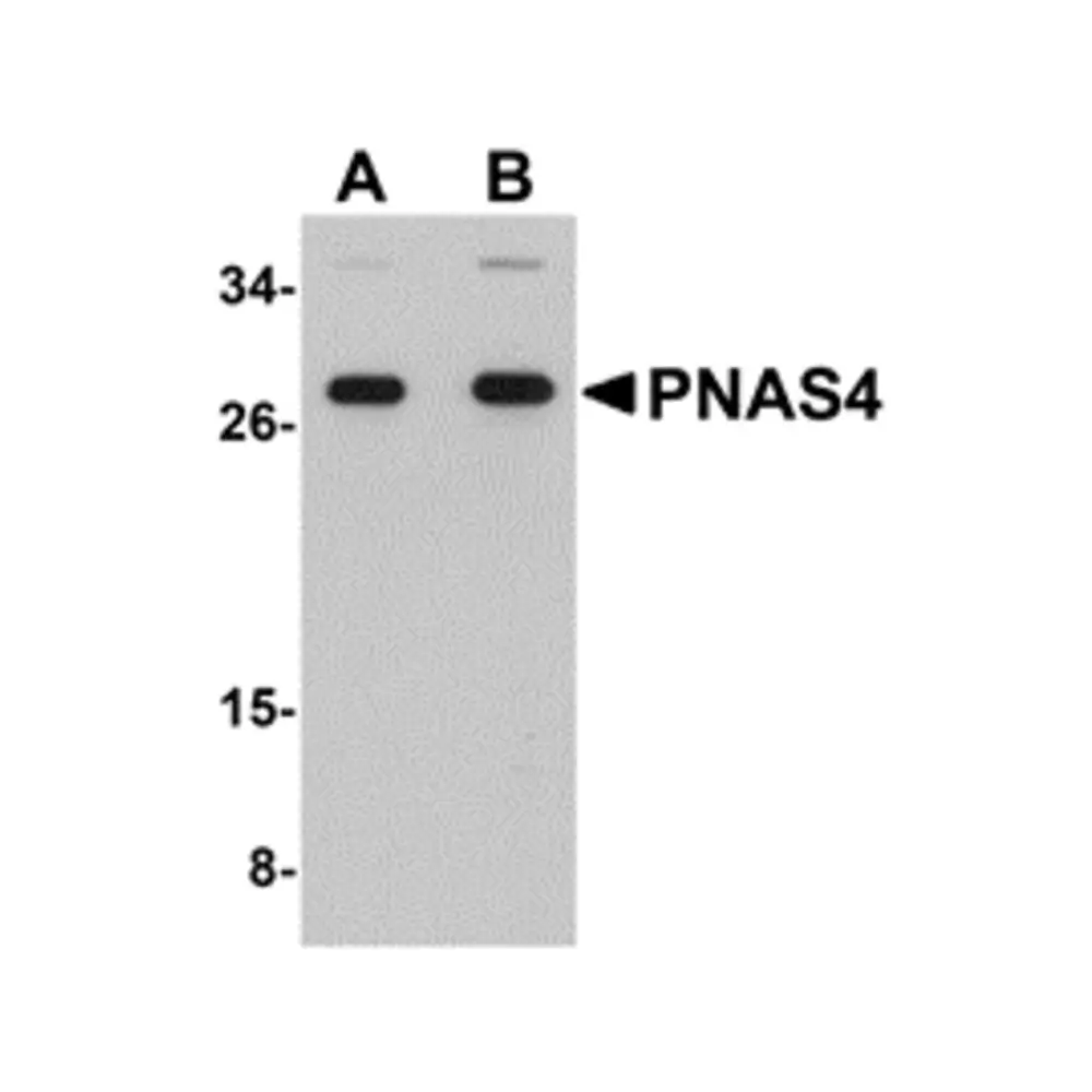 ProSci 5217_S PNAS4 Antibody, ProSci, 0.02 mg/Unit Primary Image