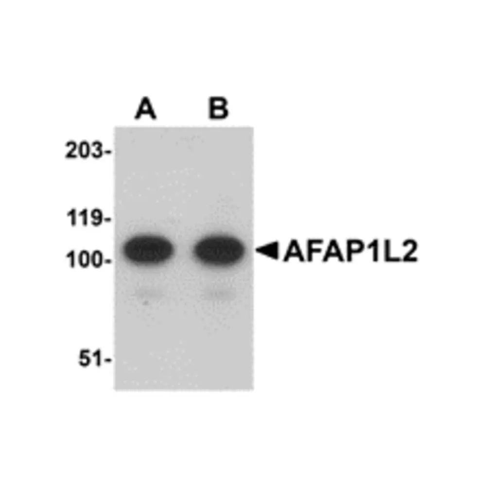 ProSci 5221_S AFAP1L2 Antibody, ProSci, 0.02 mg/Unit Primary Image