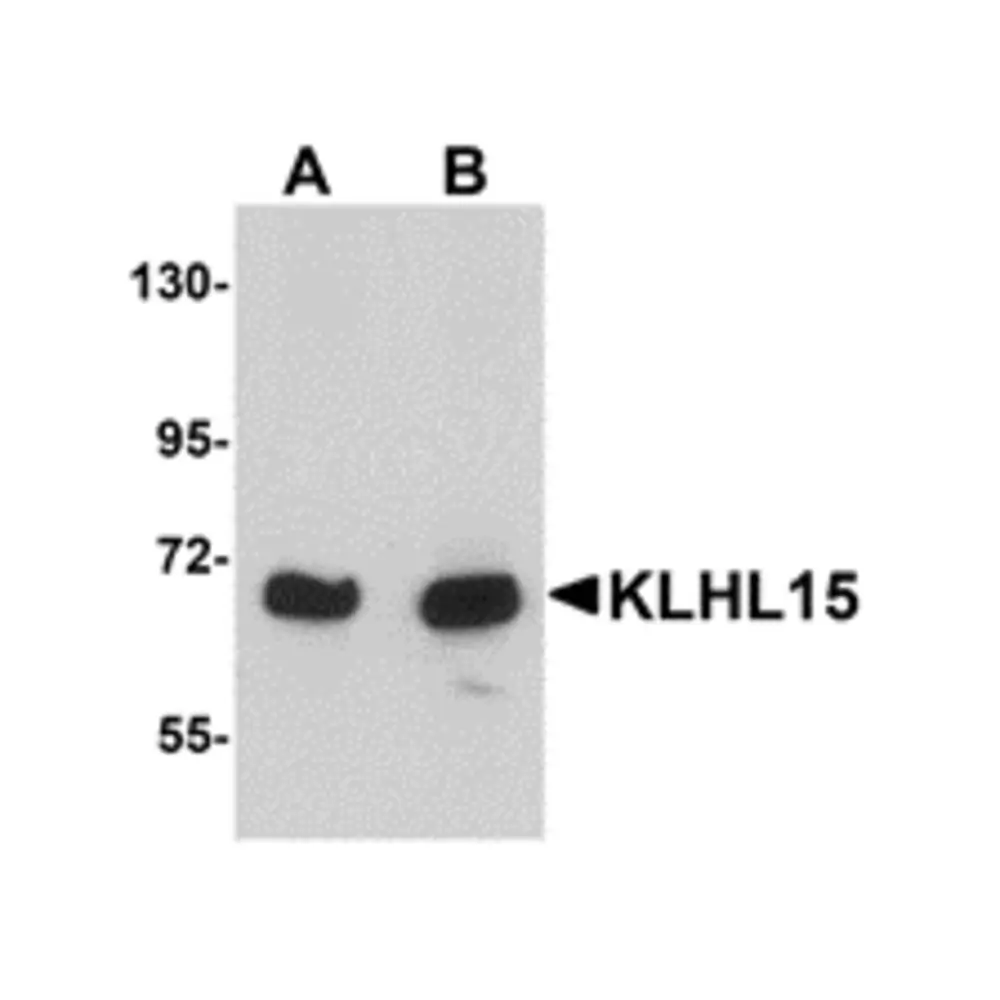 ProSci 5223 KLHL15 Antibody, ProSci, 0.1 mg/Unit Primary Image