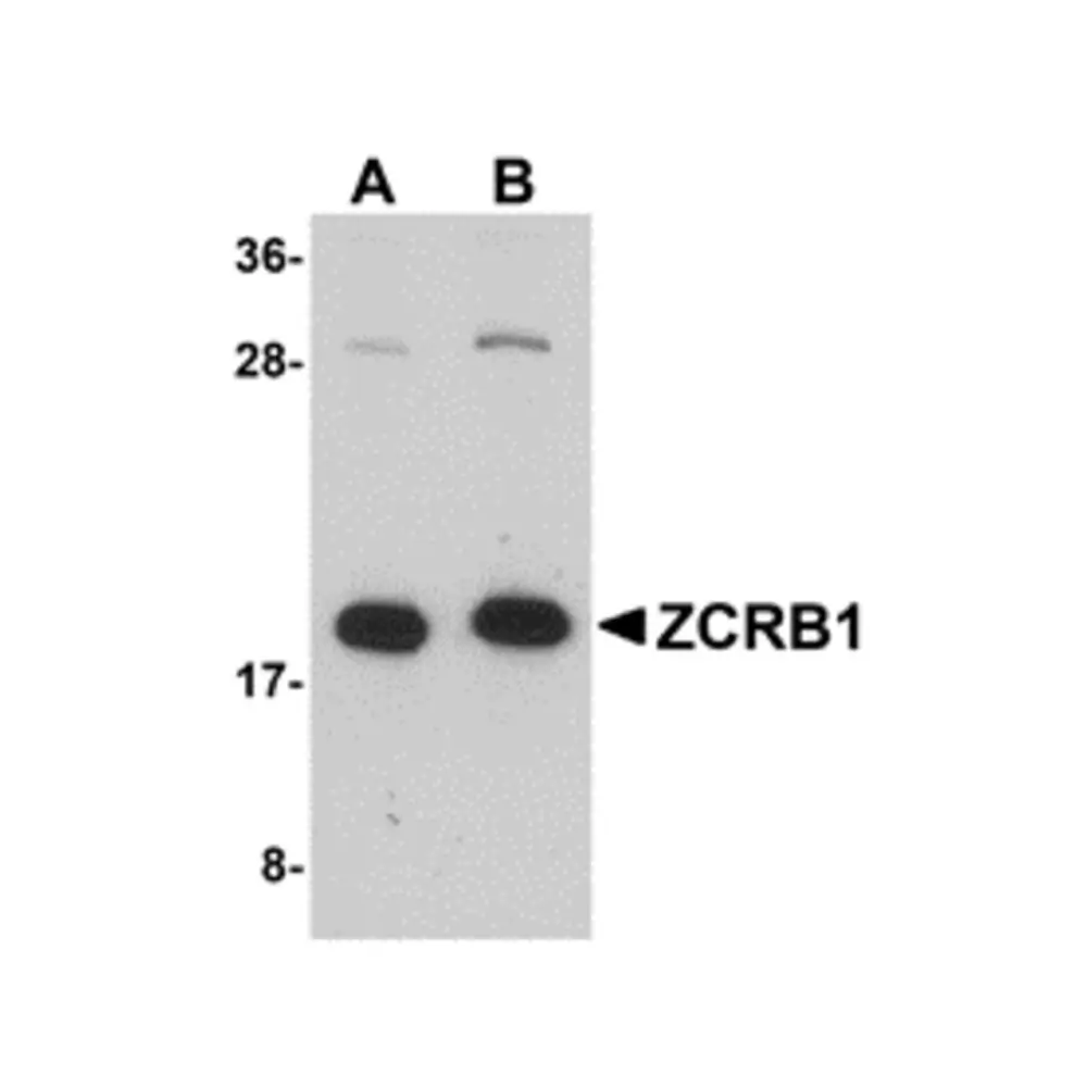 ProSci 5225 ZCRB1 Antibody, ProSci, 0.1 mg/Unit Primary Image