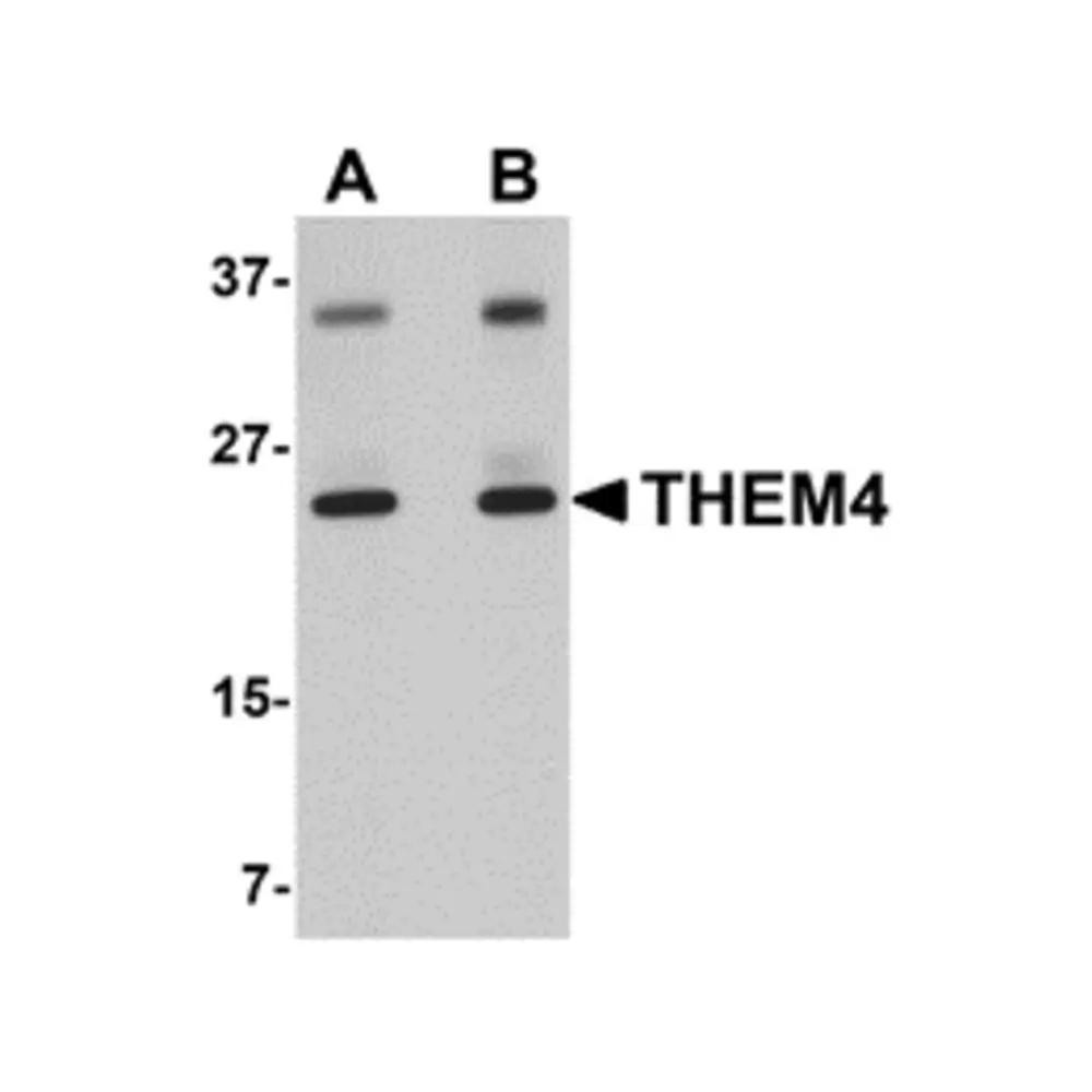 ProSci 5227 THEM4 Antibody, ProSci, 0.1 mg/Unit Primary Image