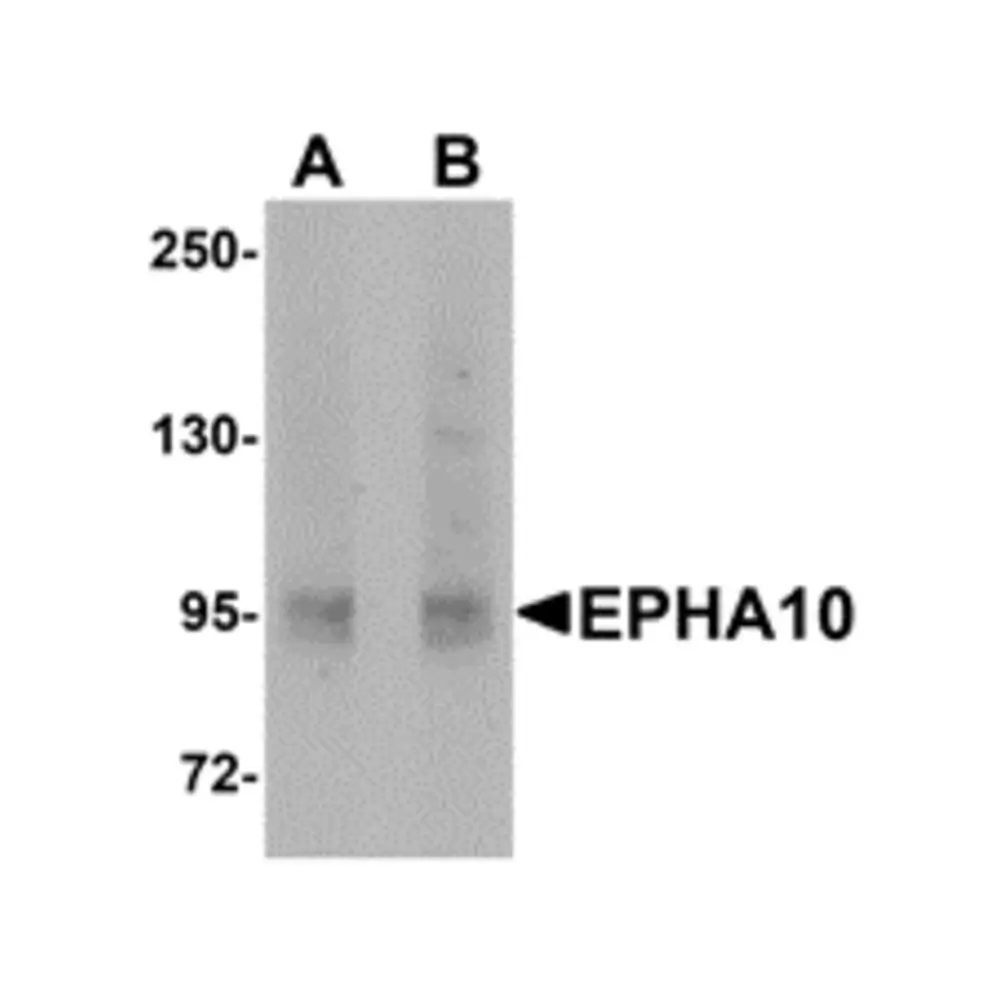 ProSci 5253 EphA10 Antibody, ProSci, 0.1 mg/Unit Primary Image