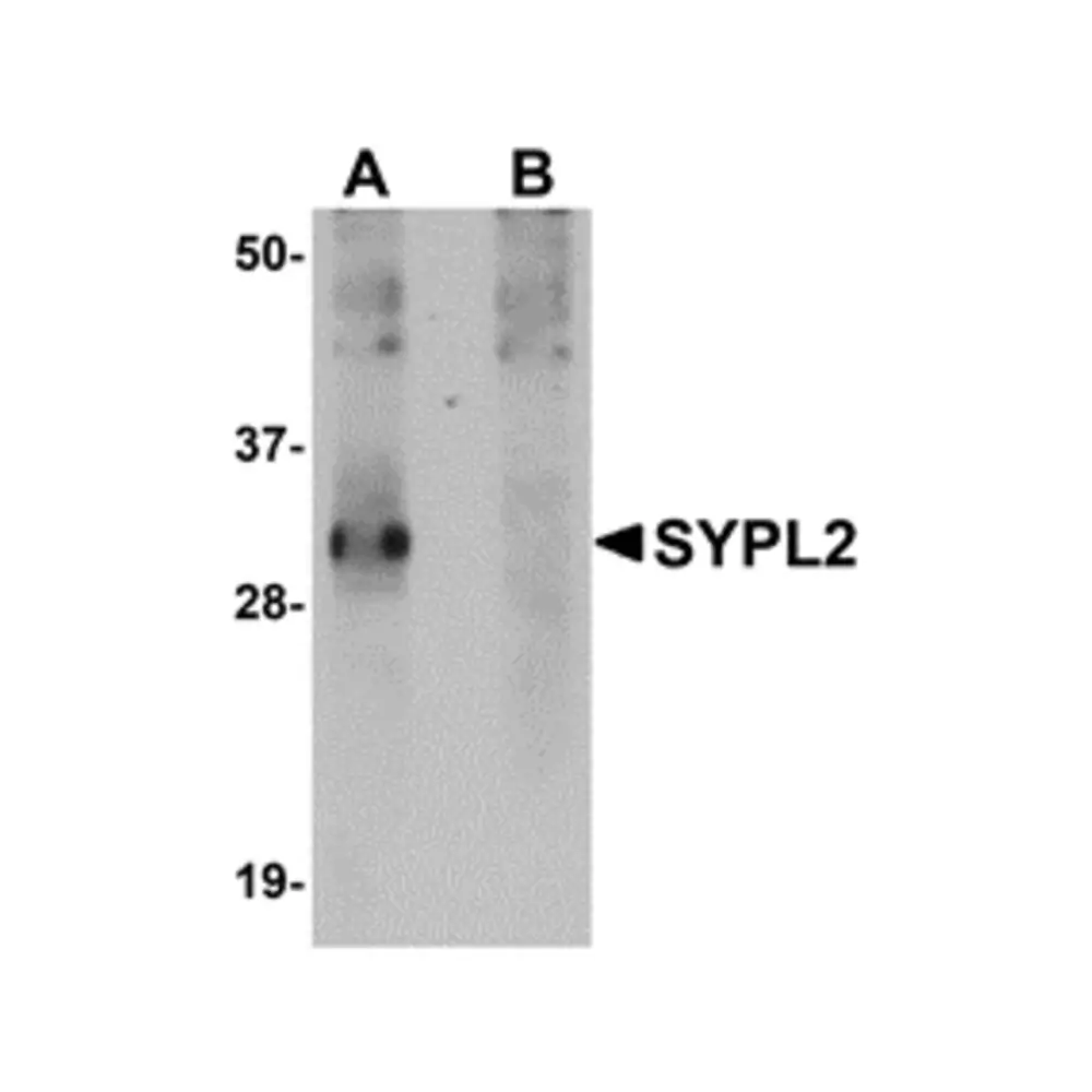 ProSci 5255_S SYPL2 Antibody, ProSci, 0.02 mg/Unit Primary Image