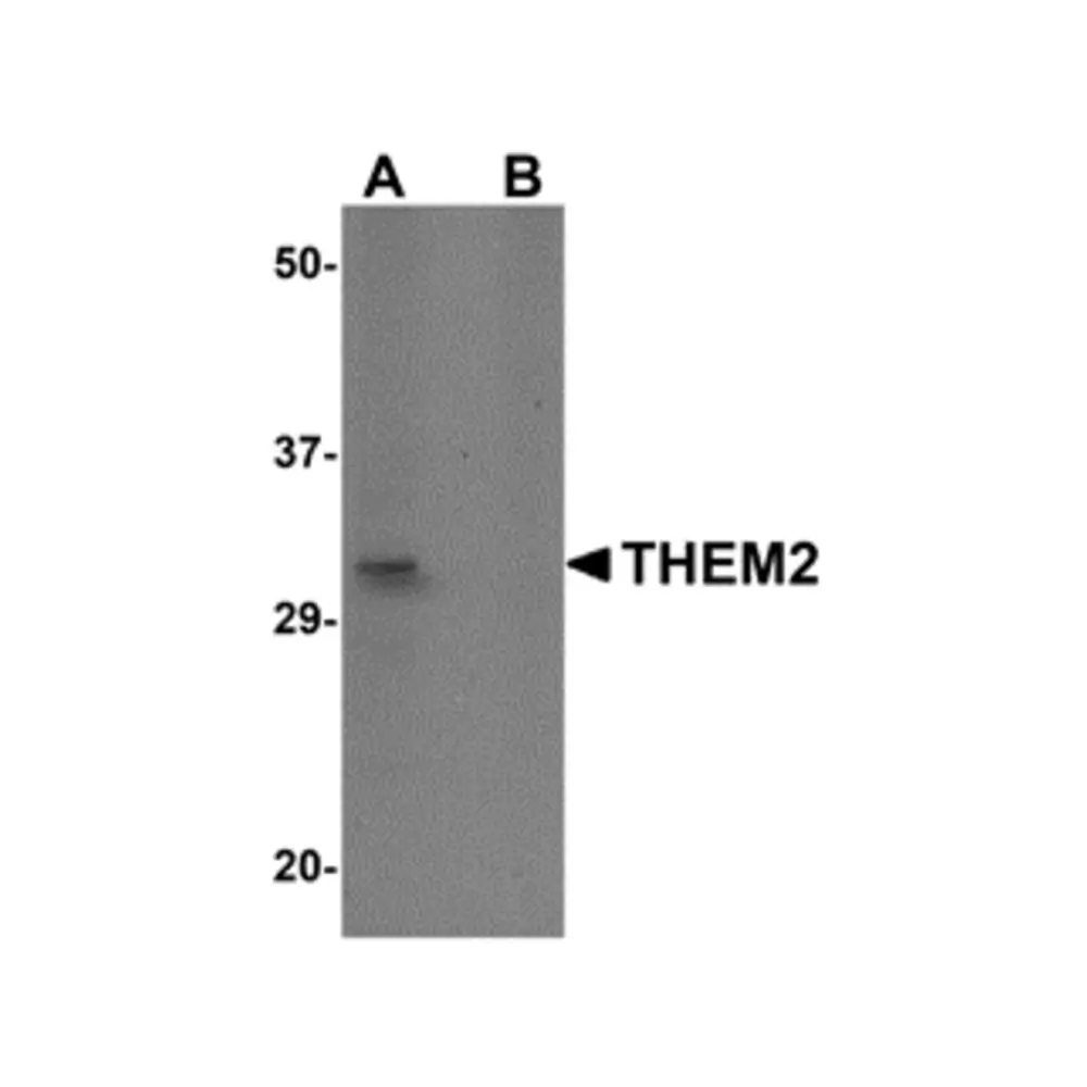 ProSci 5257 THEM2 Antibody, ProSci, 0.1 mg/Unit Primary Image