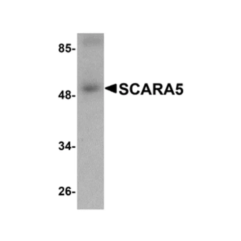 ProSci 5259 SCARA5 Antibody, ProSci, 0.1 mg/Unit Primary Image