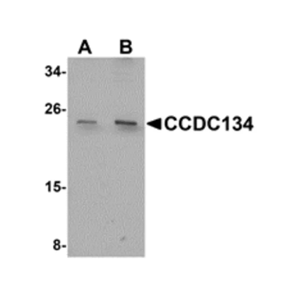 ProSci 5265_S CCDC134 Antibody, ProSci, 0.02 mg/Unit Primary Image