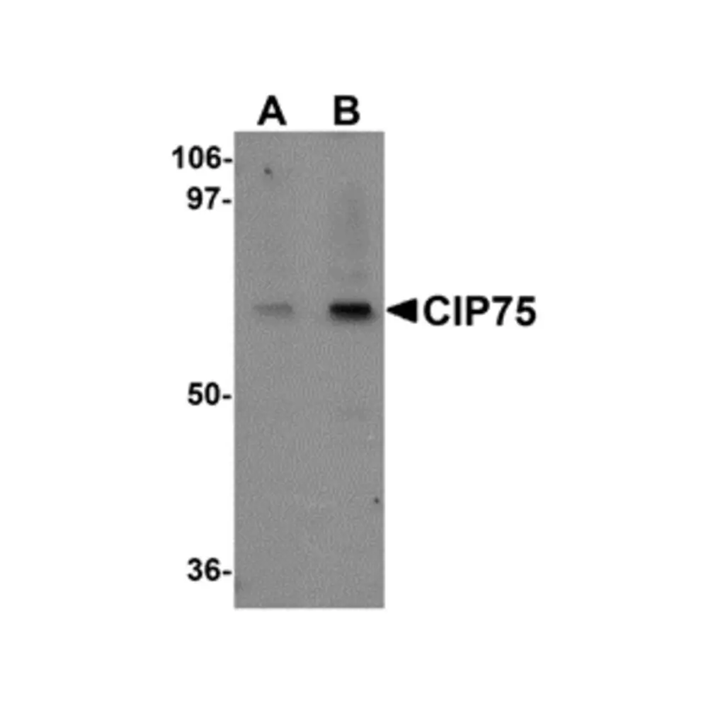 ProSci 5267_S CIP75 Antibody, ProSci, 0.02 mg/Unit Primary Image