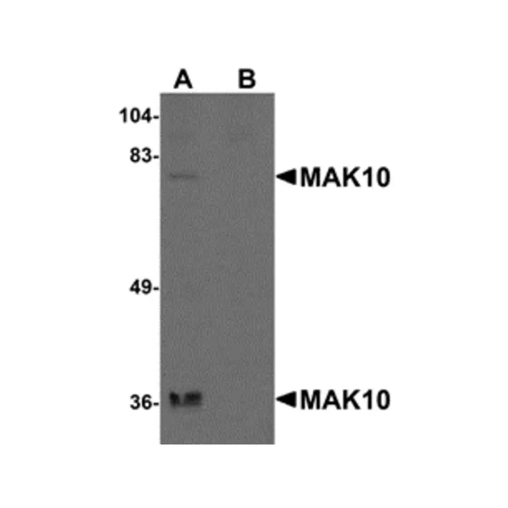 ProSci 5271 MAK10 Antibody, ProSci, 0.1 mg/Unit Primary Image