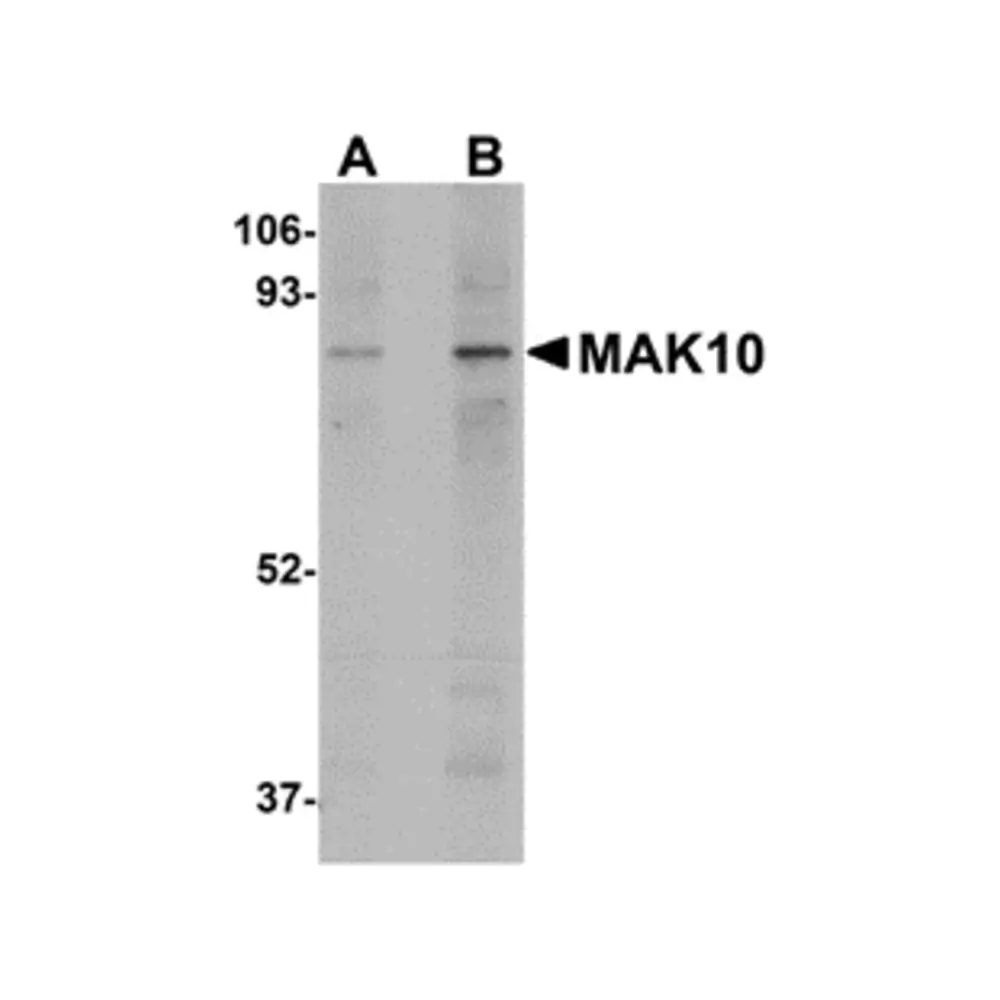 ProSci 5273 MAK10 Antibody, ProSci, 0.1 mg/Unit Primary Image