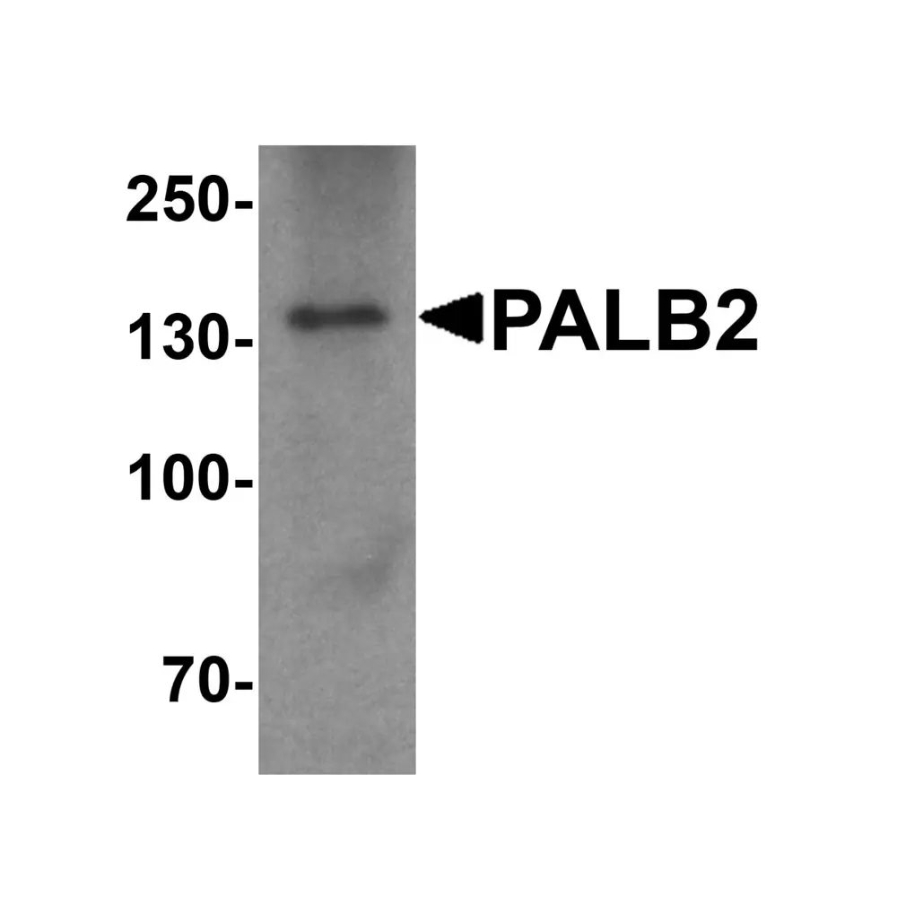 ProSci 5275_S PALB2 Antibody, ProSci, 0.02 mg/Unit Primary Image