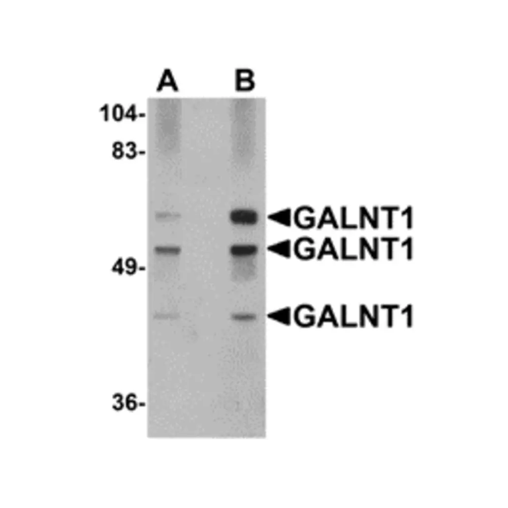 ProSci 5281 GALNT10 Antibody, ProSci, 0.1 mg/Unit Primary Image