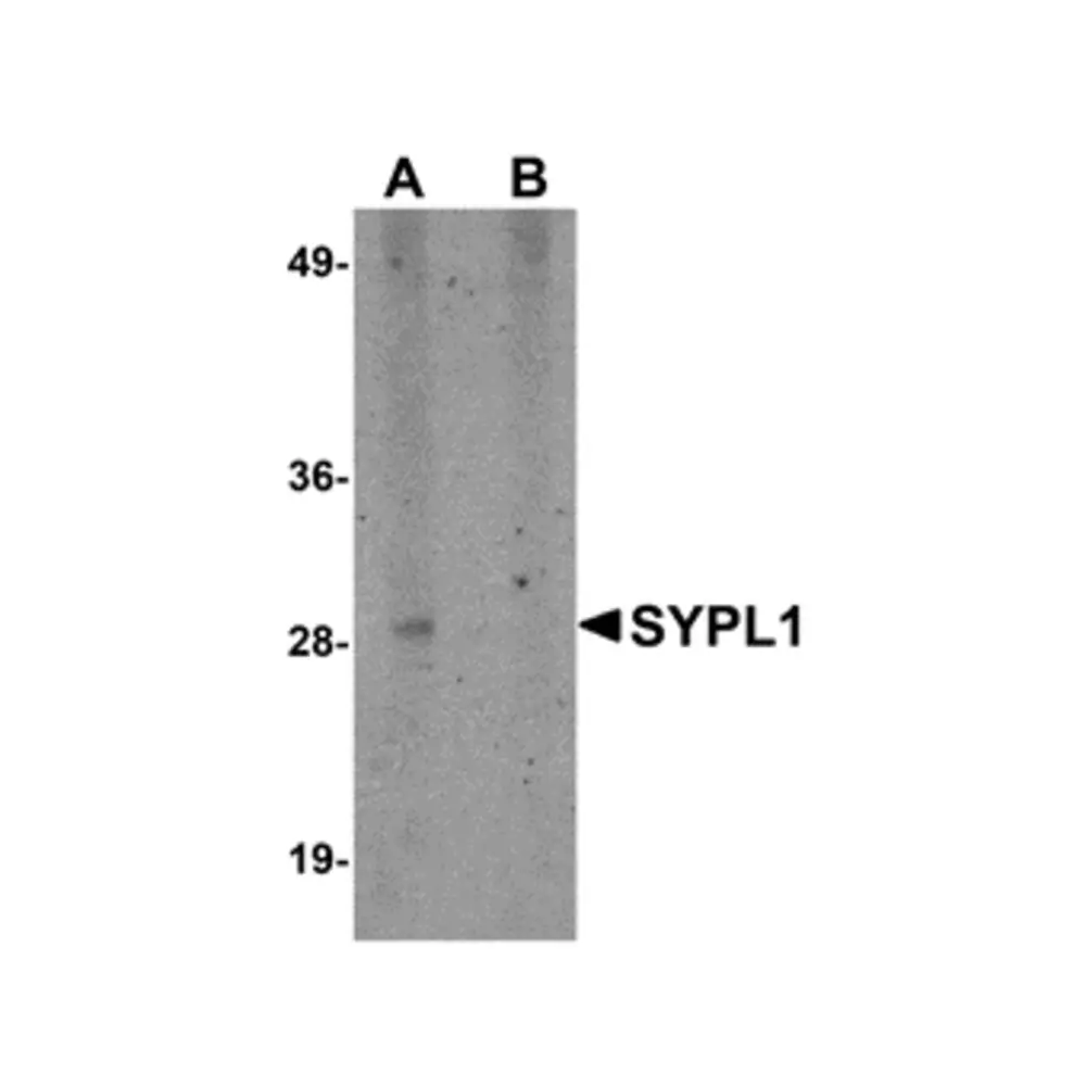 ProSci 5285_S SYPL1 Antibody, ProSci, 0.02 mg/Unit Primary Image