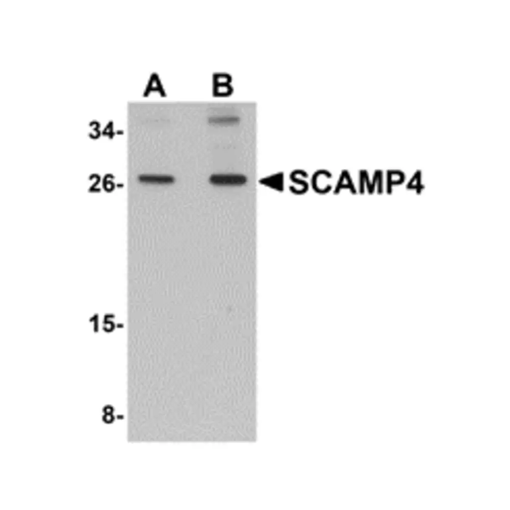 ProSci 5289 SCAMP4 Antibody, ProSci, 0.1 mg/Unit Primary Image